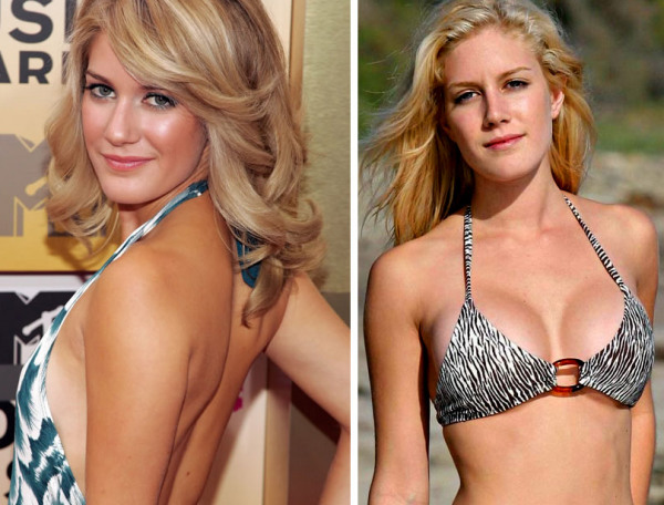 heidi montag before and after plastic surgery. Heidi Montag Had Lots of