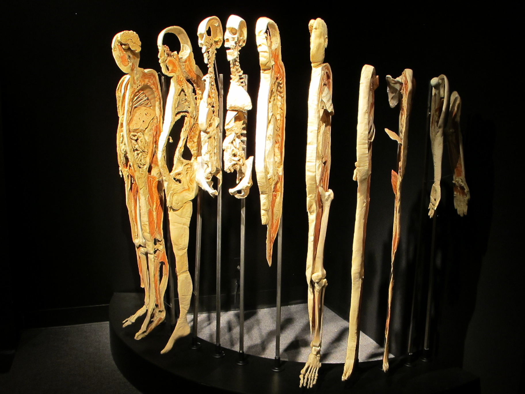 Body-Worlds-Layers-St-Louis-Science-Cent
