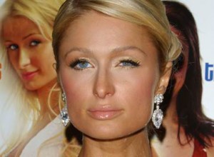 paris-hilton-lazy-eye